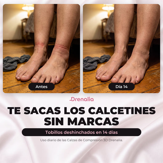Calzas 3D Drenalia® - Deshincha tus Piernas