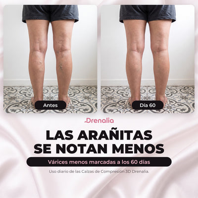 Calzas 3D Drenalia® - Deshincha tus Piernas