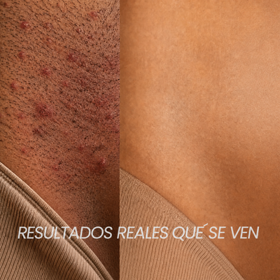 Lunéa™ - Vello fino y menos visible con Raiz de Cyperus Rotundus