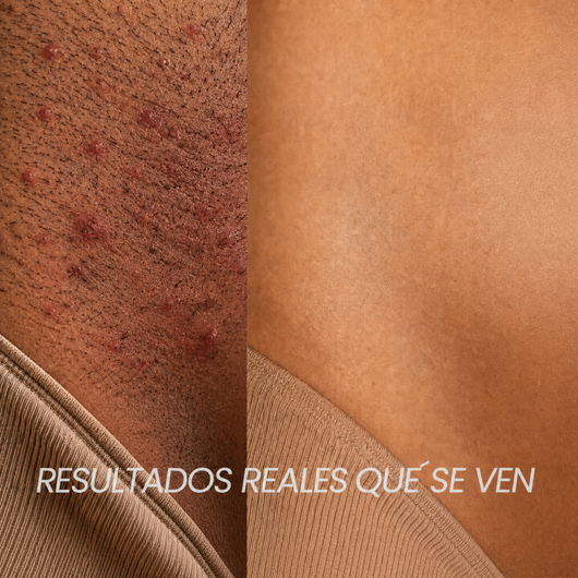 Lunéa™ - Vello fino y menos visible con Raiz de Cyperus Rotundus
